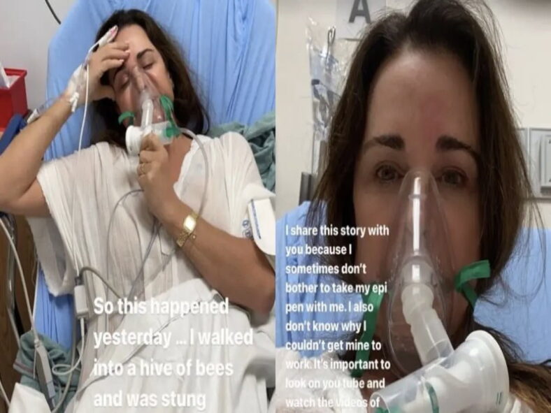 Kyle Richards Hospitalized After a Scary Incident With Bees