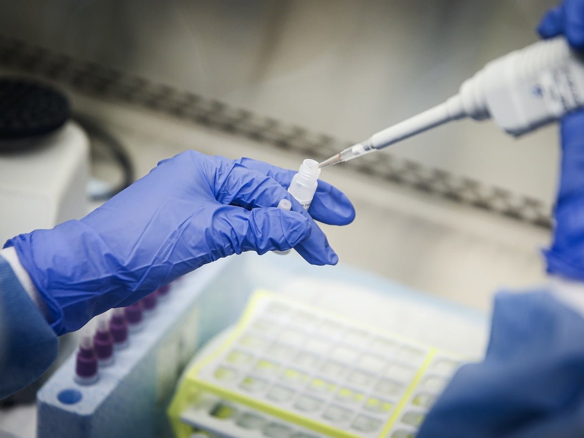 White House Looks to Purchase $1 Billion At-Home COVID-19 Test