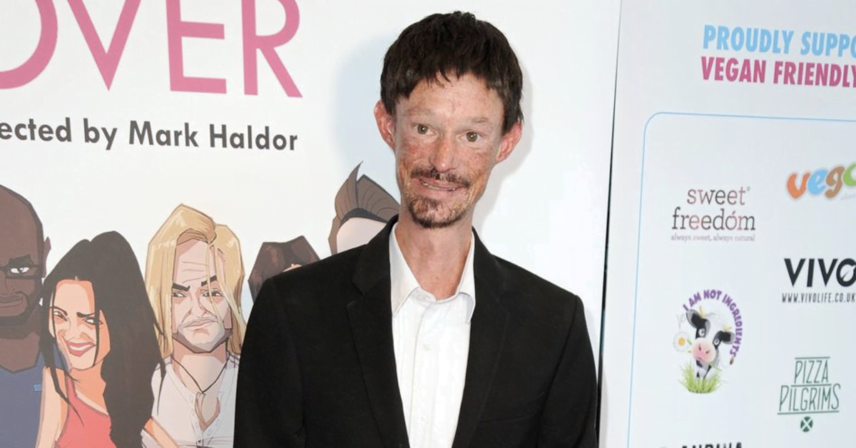 Game of Thrones Star’s Untold Struggles- Darren Kent's Legacy